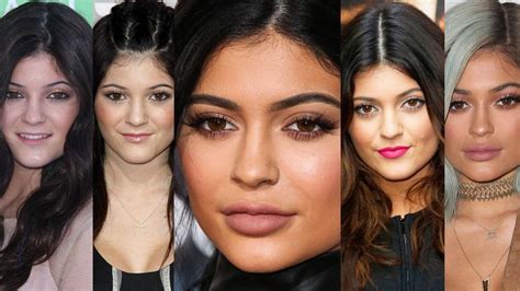 Kylie Jenner’s Transformation – Her Face & Body。